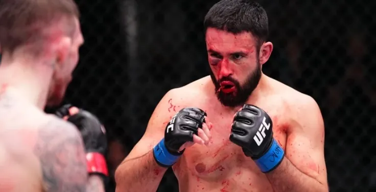 CENAS FORTES - Lábio de lutador do UFC rasga no primeiro round
