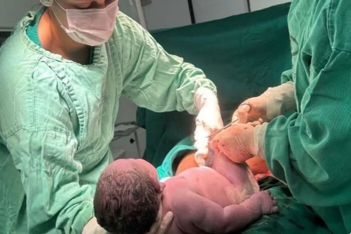 INACREDITÁVEL! VOCÊ VIU? - Bebê gigante quebra recorde e nasce com 6,2 kg em Minas Gerais
