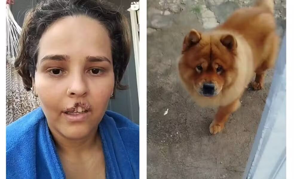 CASO POLÊMICO - Cachorro é submetido à eutanásia após ataque à tutora em Ji-Paraná