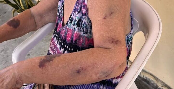 FAMÍLIA DESTRUÍDA - Homem é preso após agredir a mãe idosa de 68 anos no bairro Tucumanzal, em Porto Velho 

