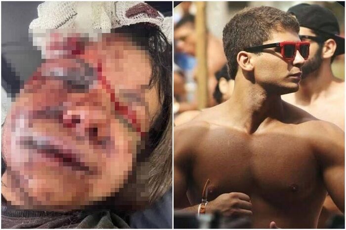 BRUTALIDADE - Mulher espancada com 60 socos pelo ex: “Ele disse que iria me matar”