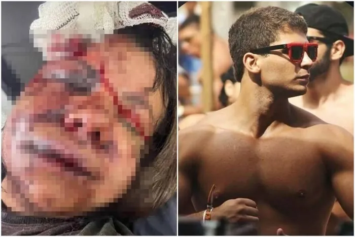 BRUTALIDADE - Mulher espancada com 60 socos pelo ex: “Ele disse que iria me matar”
