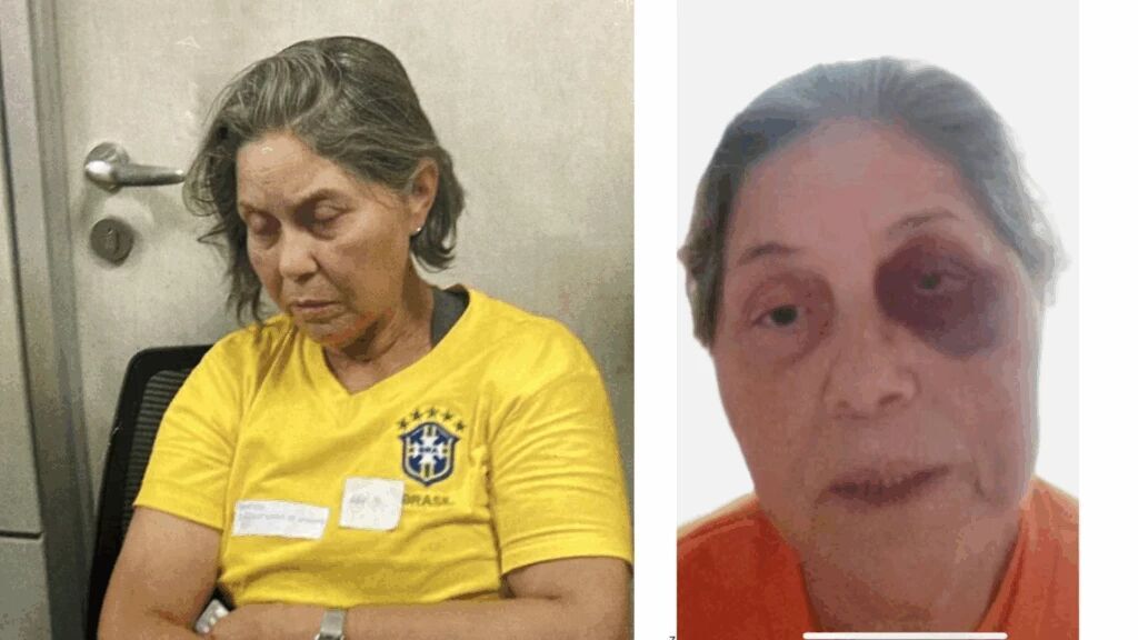 TORTURADA NA DITADURA DE LULA - Tortura e agressão contra idosa do 8/1 é protocolada na OEA