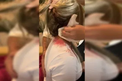 AGRESSÕES - Mulher acusa vizinha de atiçar cachorro para mordê-la e também de ataque com pedra em Vilhena