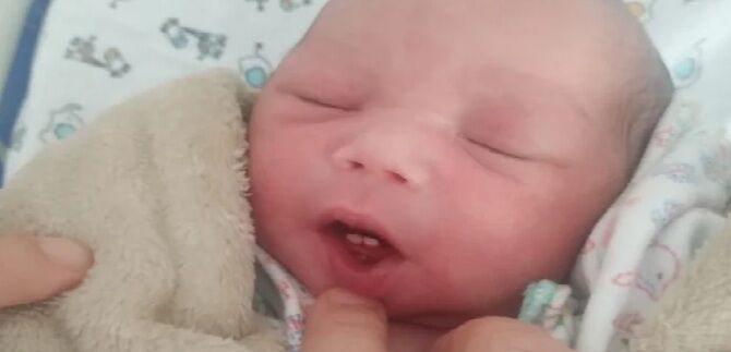 CORPO HUMANO - Bebê nasce com dois dentes em hospital do DF e surpreende família