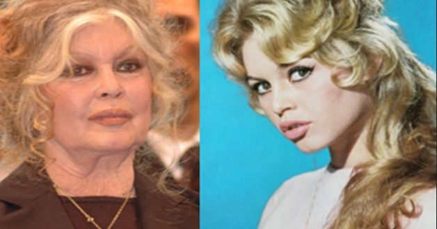 Símbolo sexual do cinema nos anos 60/70 Brigitte Bardot recebe alta após internação em estado grave