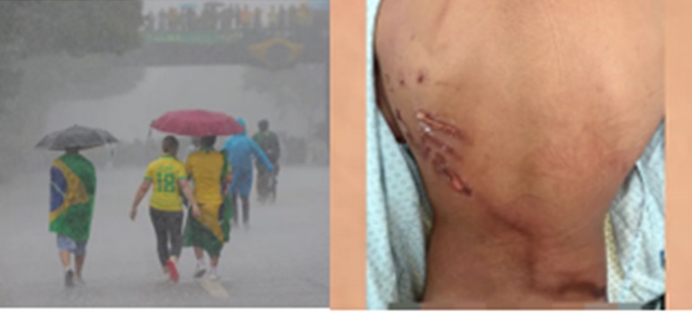 Raio não matou ninguém em Brasília e nenhuma vítima se arrepende de ter participado do 'Acorda Brasil'