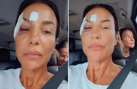 Ivete Sangalo deixa hospital após diagnóstico; saiba o que aconteceu