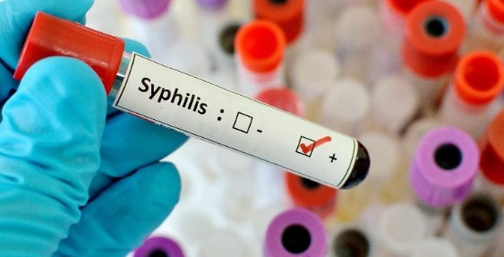 SUS passa a oferecer antibiótico para prevenção de sífilis e clamídia após exposição