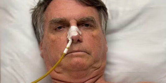 Sem prisão domiciliar, Bolsonaro tem piora da função renal e disparada no quadro inflamatório