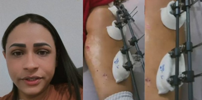 Paciente do SUS espera transferência há 40 dias e família denuncia agravamento de infecção na Capital