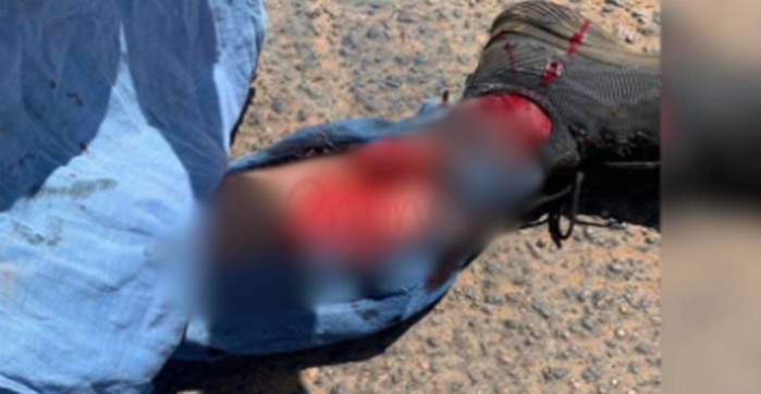 TRÂNSITO VIOLENTO - Comerciante tem perna dilacerada após grave acidente entre moto e carro em Vilhena

