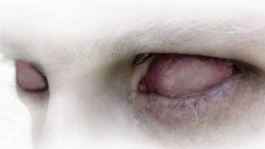 A empresa de biotecnologia Bioquark tentará ressuscitar 20 mortos nos EUA