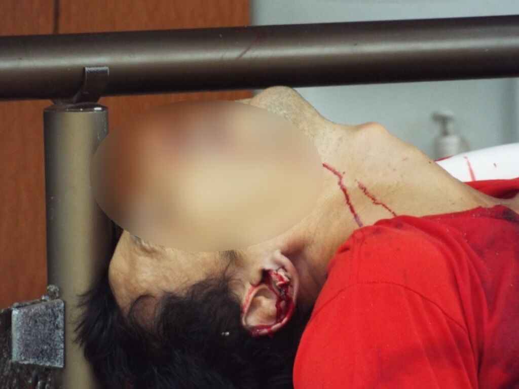 COVARDIA: Homem de muleta é morto com seis tiros no peito