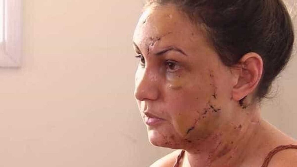Mulher conta como foi espancada por namorado que se matou em motel