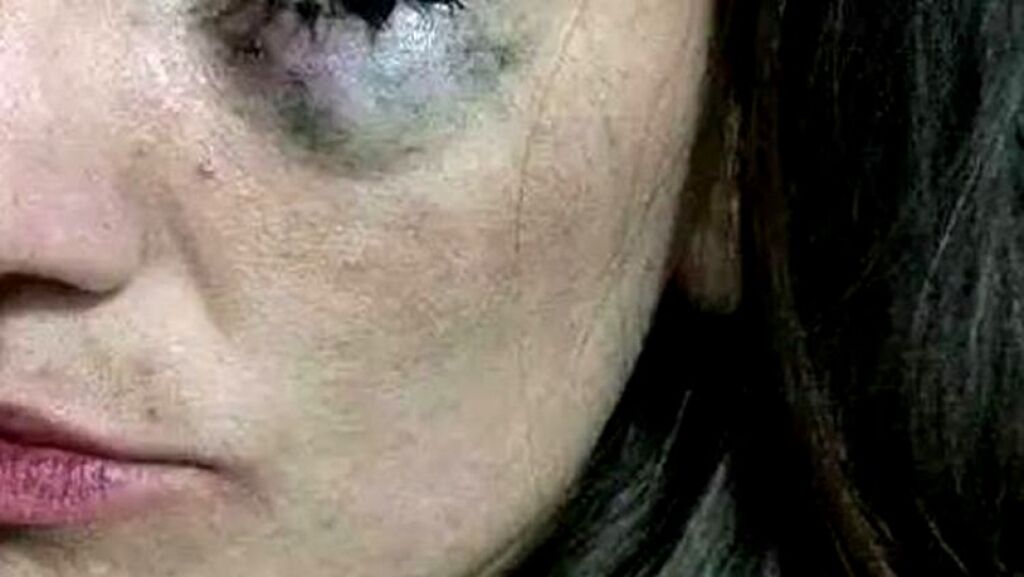 Mulher é surrada por marido em bebedeira com amigo