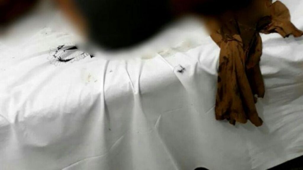 Mulher tem 90% do corpo queimado em explosão enquanto consumia drogas e bebida