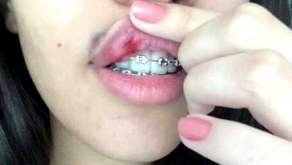 Pai é preso por surrar filha que desrespeitava avó