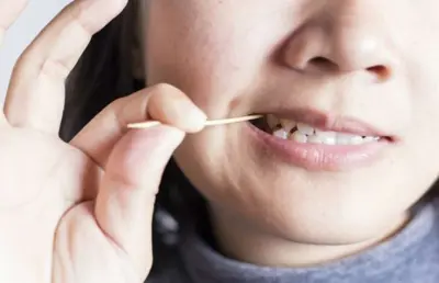 Palitar os dentes, pode ou não pode?