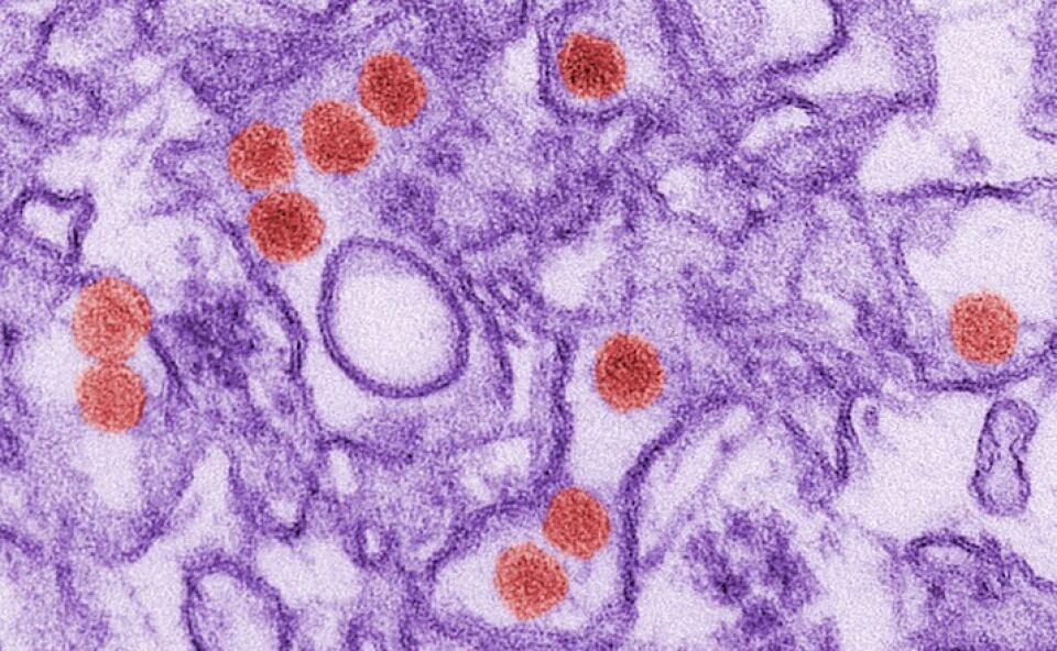 Zika vírus contra tumores agressivos