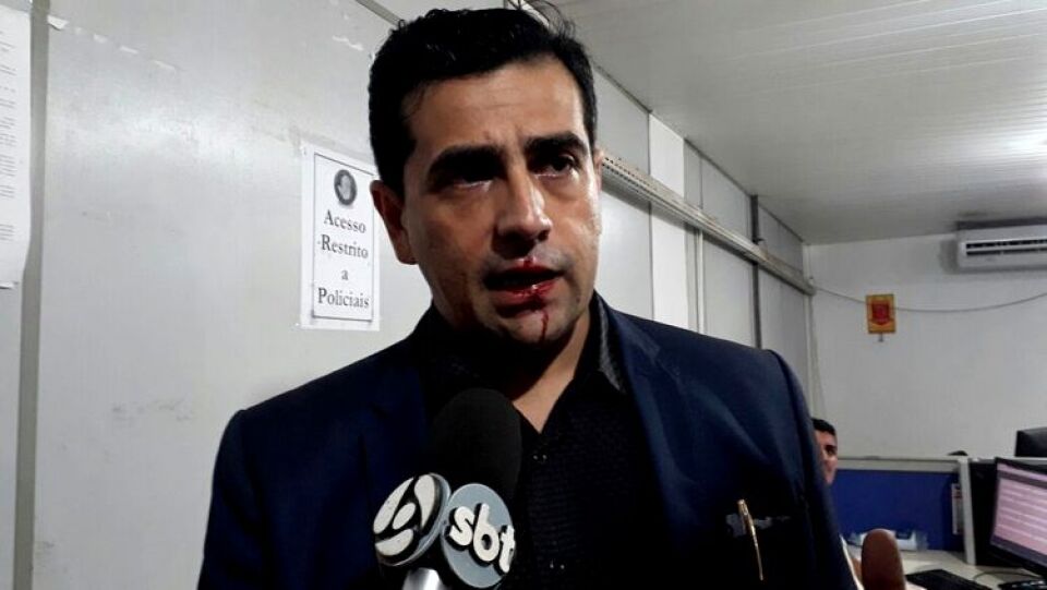 URGENTE!!! NA DELEGACIA:  Breno Mendes foi atacado por agente de trânsito