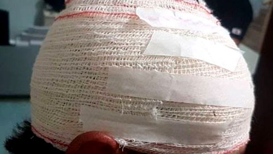 Suspeito é preso após atacar rival a pauladas