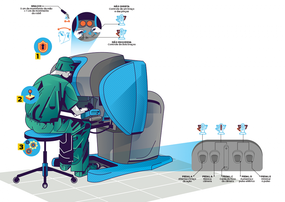 Como é uma cirurgia feita por robôs?