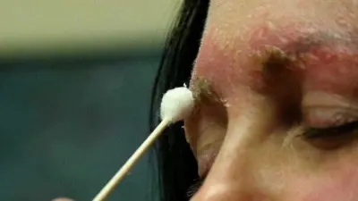 Microblading: mulher quase morre após infecção na sobrancelha