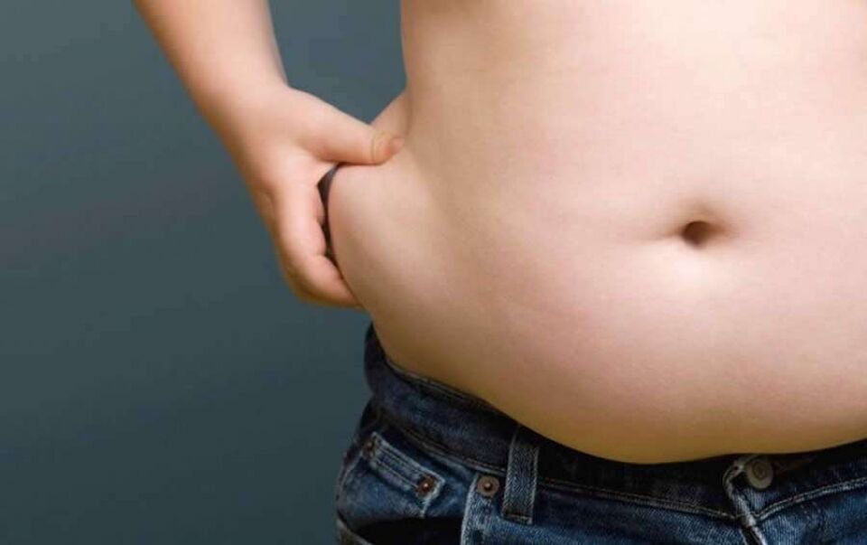 Obesidade pode estar relacionada a diversos problemas de circulação, como varizes e trombose