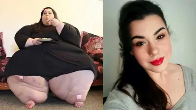 Com quase 300 kg, jovem muda hábitos e vira outra pessoa