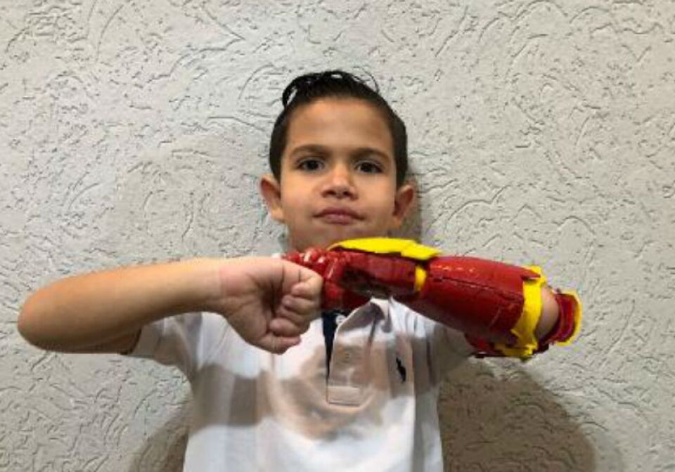 Menino ganha prótese do homem de ferro e autoestima sobe