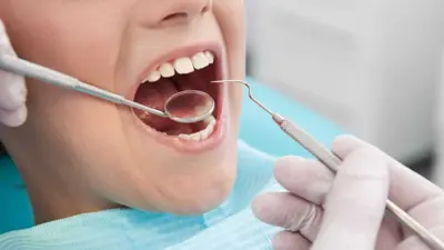 Restaurações dentárias escurecidas devem ser trocadas pelas brancas?