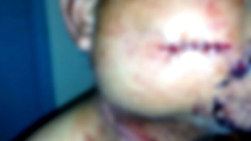 Idoso é baleado no rosto durante tentativa de assalto em Porto Velho