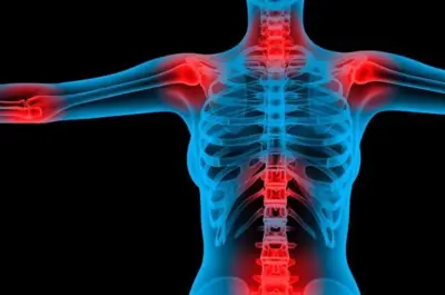 Aparelho reduz até 60%  das dores da fibromialgia