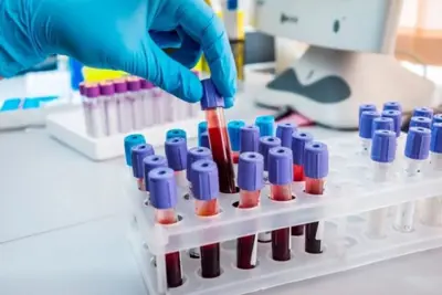 Laboratório é condenado por falha no resultado de exame