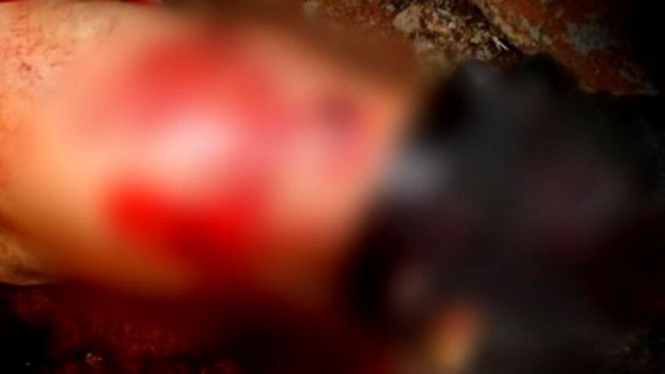 ATENTADO: Adolescente leva facada ao questionar homem que o encarava