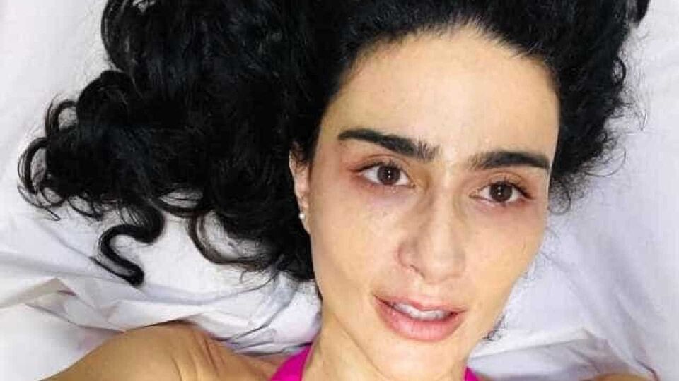Atriz que gravou agressões do marido afirma que ele fez mais vítimas