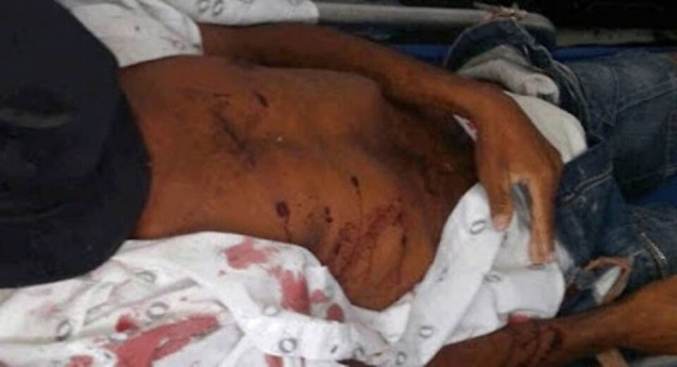 HOMEM FAZ COMENTÁRIO SOBRE PROSTITUTA E É ASSASSINADO COM TIRO NO PEITO EM RONDÔNIA