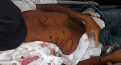 HOMEM FAZ COMENTÁRIO SOBRE PROSTITUTA E É ASSASSINADO COM TIRO NO PEITO EM RONDÔNIA