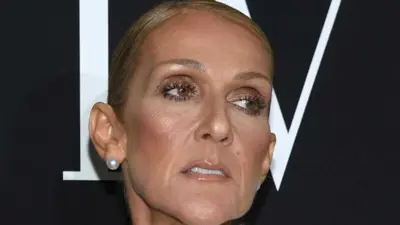 Céline Dion choca os fãs por magreza excessiva em Paris