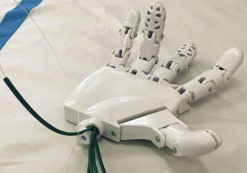 Estudantes mineiros criam prótese em 3D de baixo custo