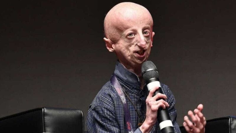 Itália opera coração de paciente com progeria pela 1ª vez