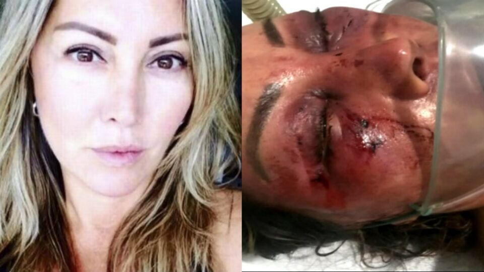 Tudo sobre a empresária que sofreu espancamento dentro da própria casa por 4 horas