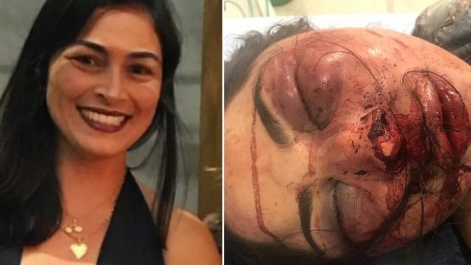 Mulher espancada pelo namorado deve ficar mais 15 dias internada