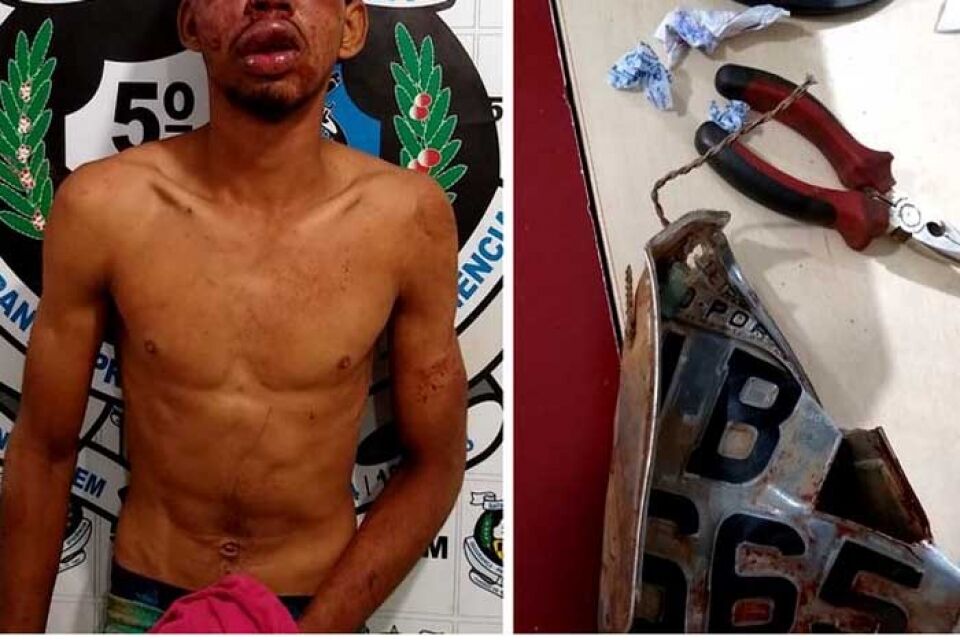 Suspeito tem rosto desfigurado após ser surrado pela população