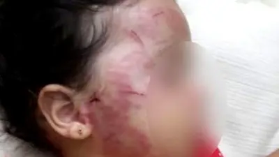 Criança é espancada pelo pai porque chorava vendo a mãe sendo agredida