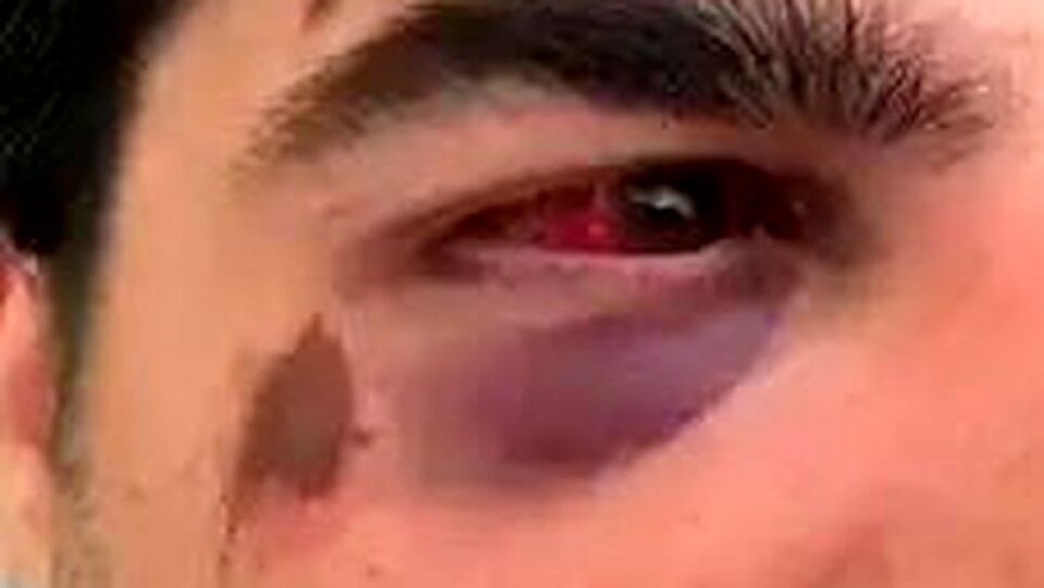 Padrasto é espancado por enteado após discutir com esposa em festa