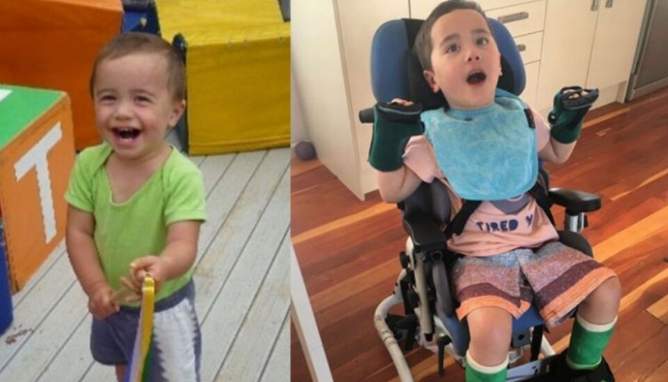 Menino fica paraplégico após engasgar com pedaço de maçã