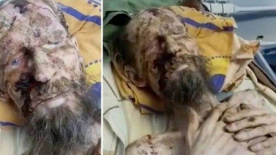 Homem é achado vivo e 'mumificado' após ser mantido 'refém' de urso