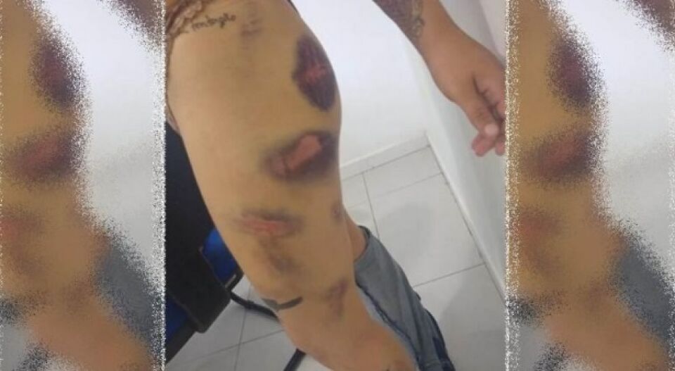 Jovem é preso por torturar e fazer ex-namorada comer fezes de animais